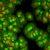 hepatocyte stained with acridine orange