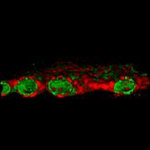 cross section image of reconstructed bile ducts