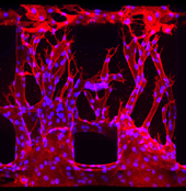 microvascular networks in a chip