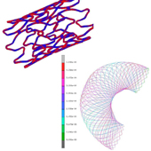 stent design and fabrication